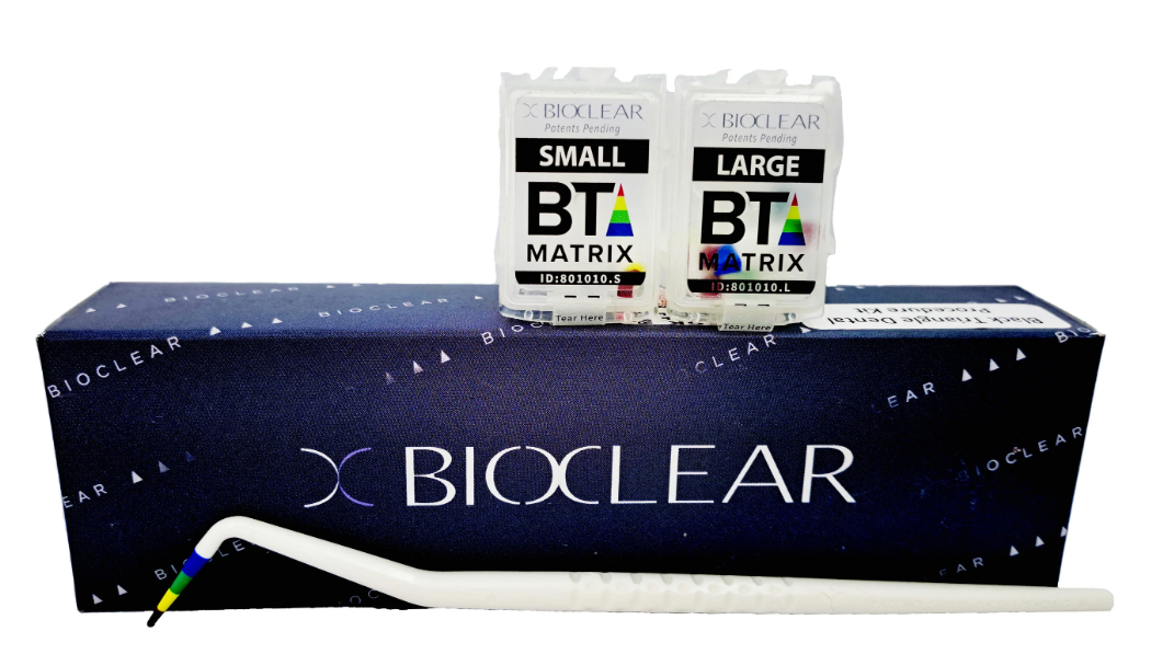 Black Triangle Procedure Kit (#801010)