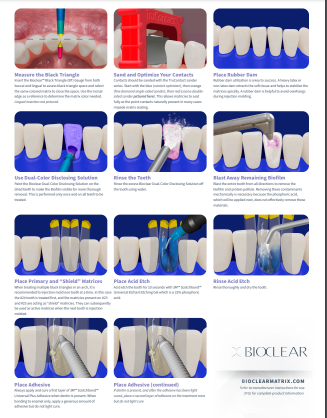 Black Triangle Procedure Kit (#801010)
