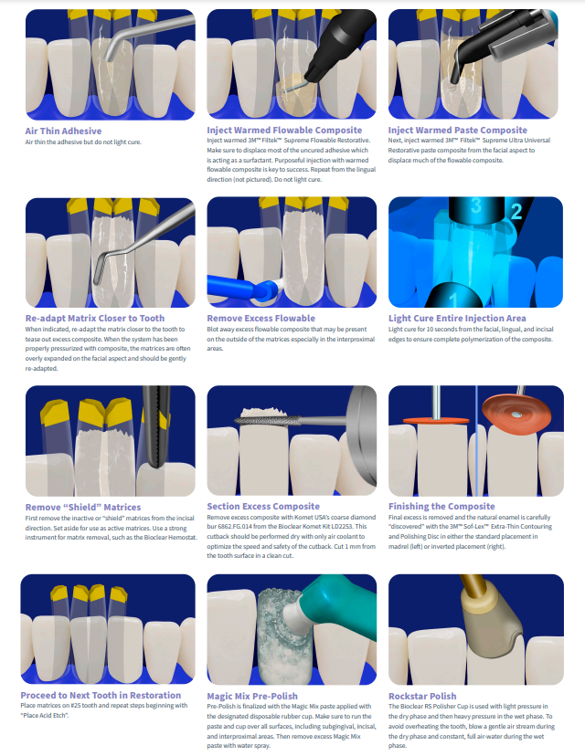 Black Triangle Procedure Kit (#801010)